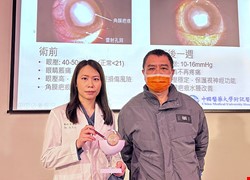 眼角膜感染竟轉複雜型青光眼 六旬長者幾乎失明 超細導管精準植入青光眼手術  搶救近盲視力